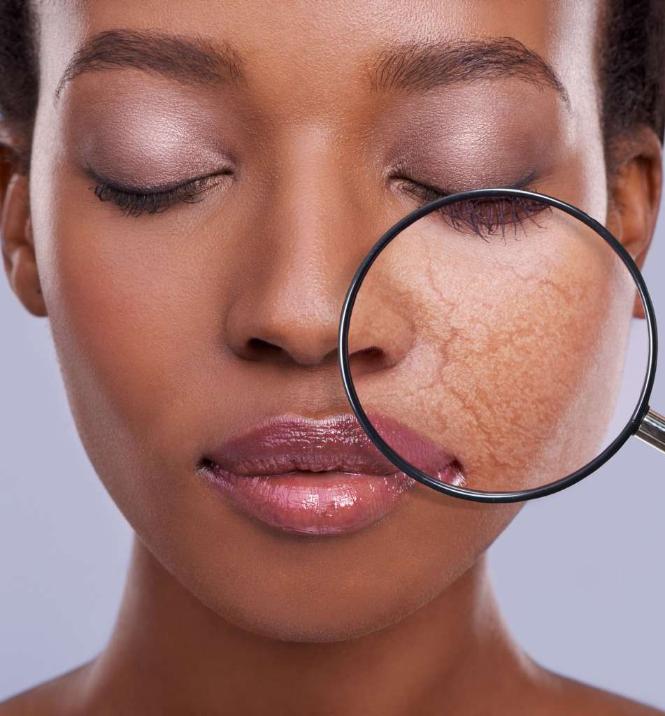 The Basic Rules of Skin Care & Acne Treatment